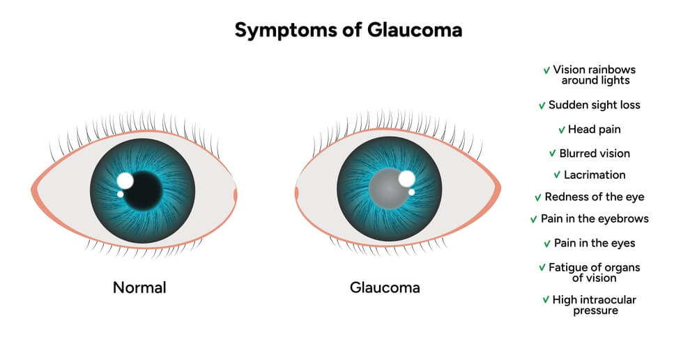 what-is-glaucoma